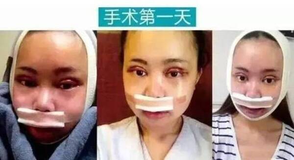 重庆女孩花百万整容成了baby 网友惊呼太像了(图)