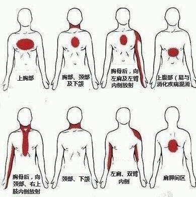 心前区疼痛范围一般是巴掌大小,不会是很局限的某一点的疼痛,而是小