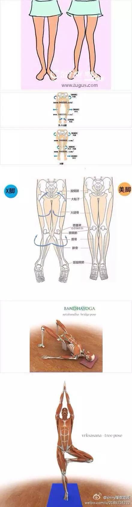 观察图片我们可以清晰的看到内外八字腿的解剖上的状态,对膝关节不