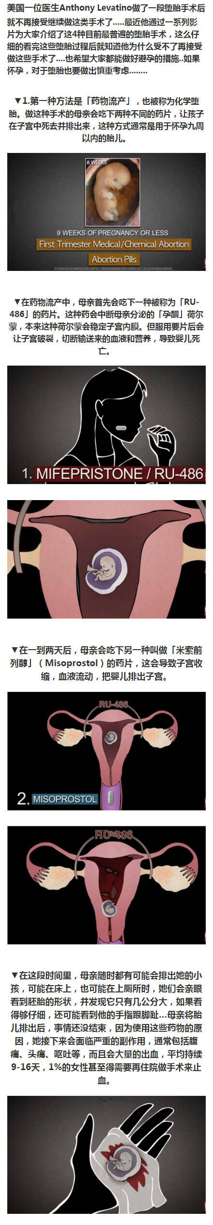 4种目前最普遍的堕胎手术 看完简直心寒！