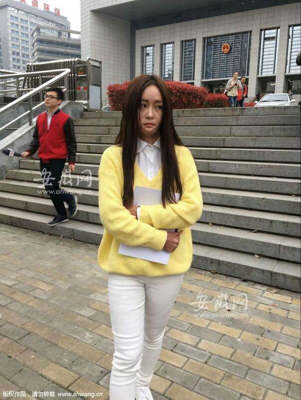合肥毁容少女周岩今获赔180余万,较一审多出8万