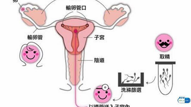 人口授精_人口普查(3)