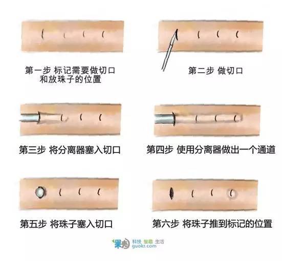 "入珠"改造大丁丁,能让对方欲仙欲死?