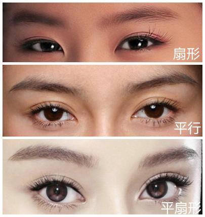 "按照形状的不同双眼皮大致可以分为三种.