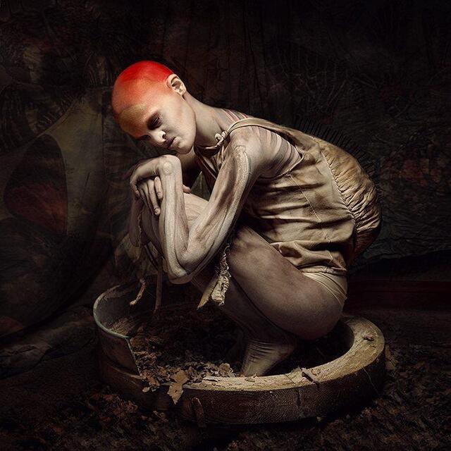 她患罕见病,先天牙齿、骨骼发育不全,却成为知