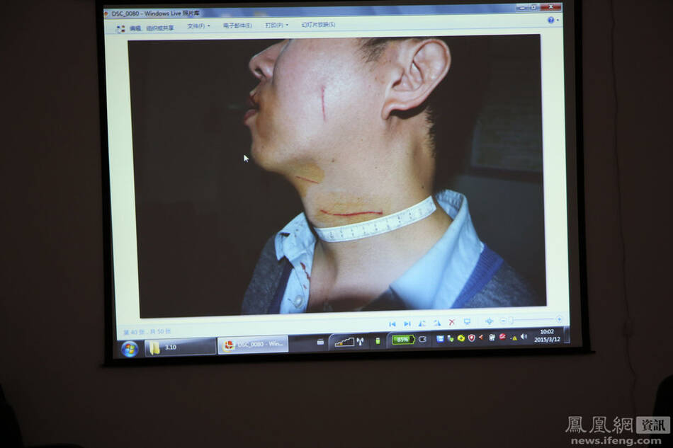 深圳女司机付某娜醉酒驾驶撞人拖行被害人200米 撕咬民警|微博