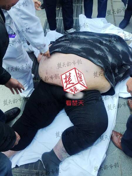 440斤重男子摔倒 20人努力2小时没扶起(组图)