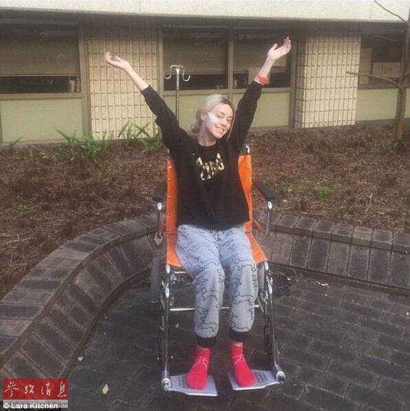 正量!少女斑秃脱下假发接受女性倒贴不完美男生女生鼓励的图片