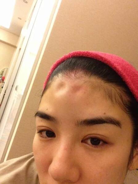 网红遭家暴胸部被打几乎变形 悉数娱圈被传惨