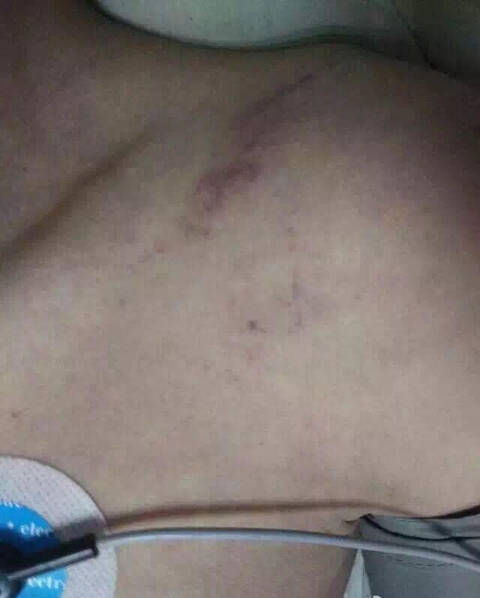 少年在网吧内被同学群殴4小时后死亡