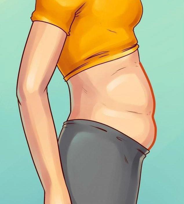 这5种不是肥胖造成的肚子