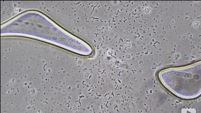 400倍显微镜下的酸奶，看完再也不喝酸奶了！