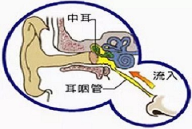 小儿中耳炎的治疗