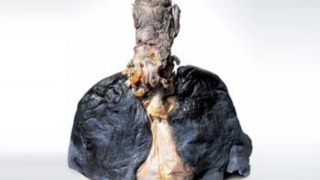 什么办法止痛 53c9c0c76b79db98aed9aac50f2f45d42edcab30_size211_w640_h360.png