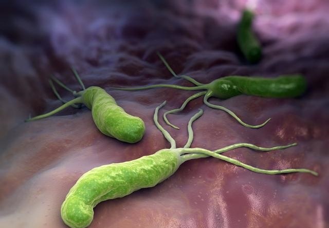 总是胃酸、胃胀,4种人最容易被幽门螺旋杆菌盯