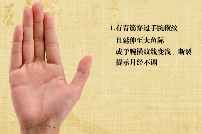 有青筋穿过手腕横纹并且延伸到大鱼际,或者手腕横纹线变浅,断裂,代表