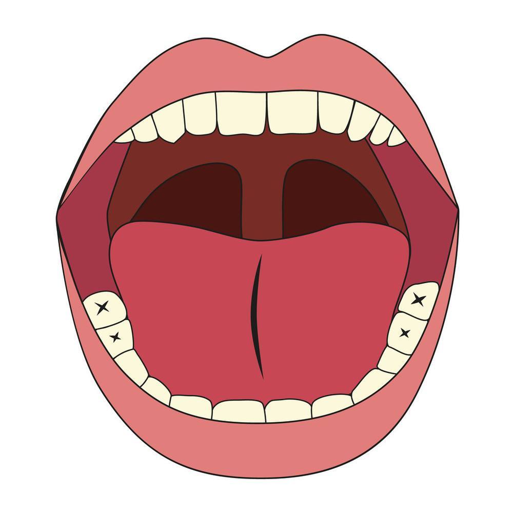 舌头尖锐湿疣