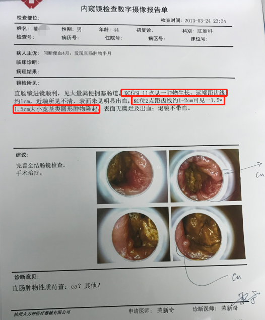 只有1-2cm的距离,如果手术的话就保不住肛门功能,只能在腹壁上做改道