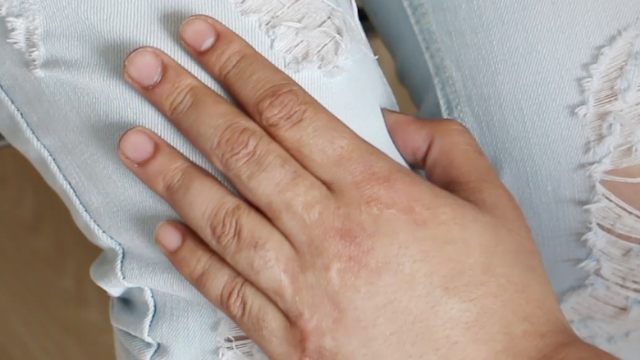 血海穴很神奇，经常按摩益处多