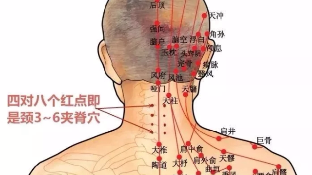 ko颈肩痛③阎王夺命锁