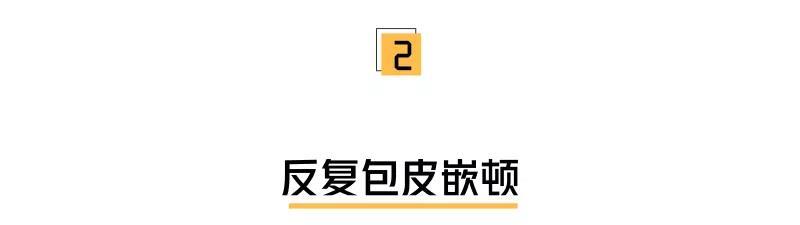 包皮要不要割?事关孩子一生,挺急的,在线等!