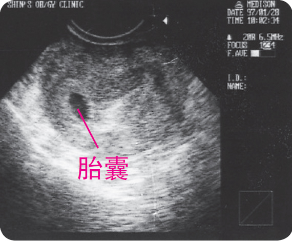 深度揭秘（怀孕试纸恶搞的图片）试纸怀孕了图片图库 第2张