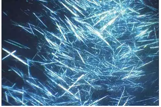 “尿酸盐结晶”是让你痛风反复的罪魁祸首！！__凤凰网