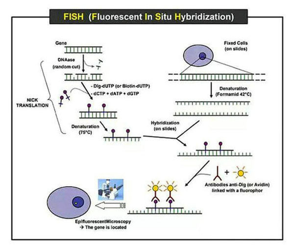 新技术应用荧光原位杂交技术检查可助力肿瘤靶向治疗 凤凰网