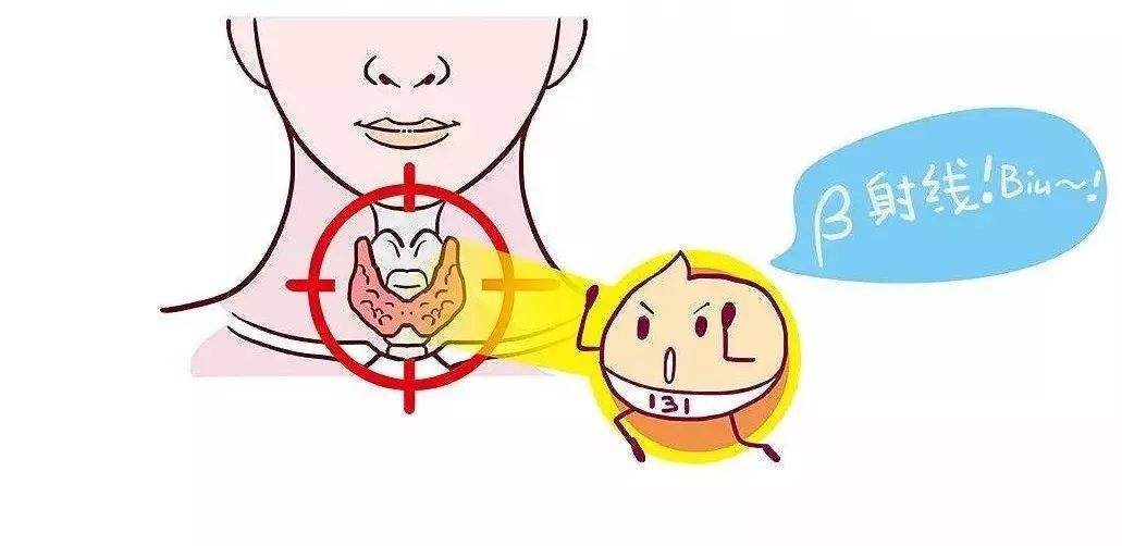 碘131治疗甲亢的基本原理