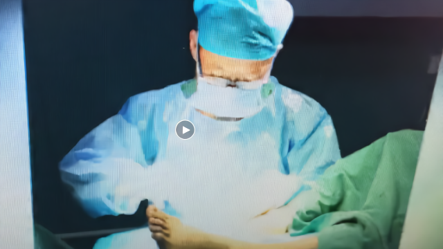 揭秘：拇外翻手术过程录