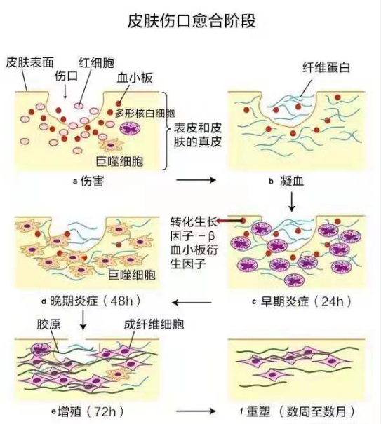 并且还会出现血小板脱颗粒和肥大细胞或组胺反应中产生组织水肿,增殖