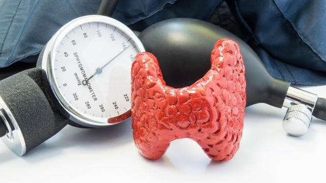 甲减最明显的症状？北京北城医院甲状腺专家讲解甲减的病因及症状