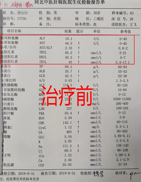 河北中医肝病医院酒精肝病例一位酒精依赖者的难忘经历