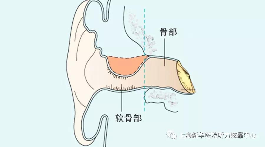 而外耳道骨部的皮肤无毛囊和腺体,因此不会发生疖肿.