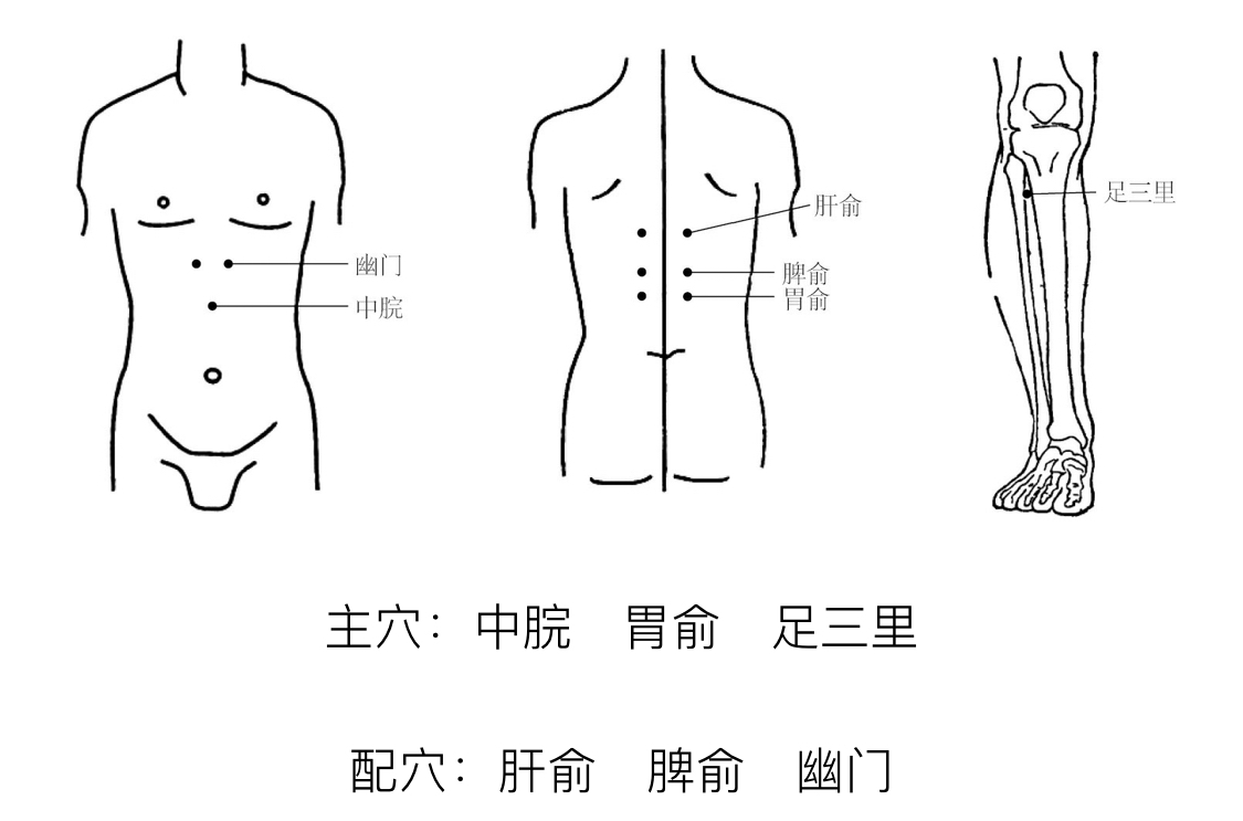 又为胃之募穴,腑之会穴,可通调腑气,和胃止痛;胃俞为足太阳膀胱经之俞