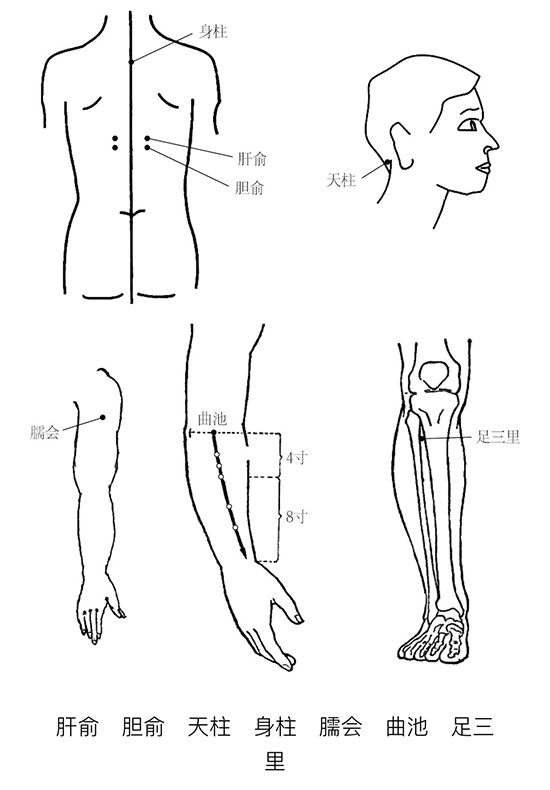 胆俞:第十胸椎棘突下,旁开 1. 5寸. 天柱:后发际正中直上 0.