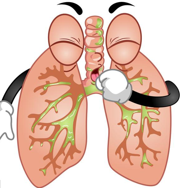 咳嗽,咳痰的肺小结节