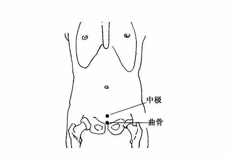 针灸穴名解——任脉腧穴 曲骨