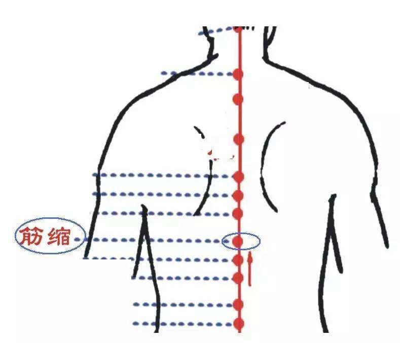 针灸穴名解——督脉腧穴 筋缩