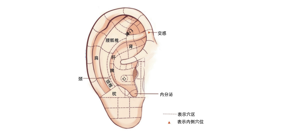 耳穴疗法颈椎病