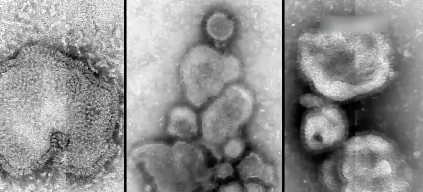 没有病毒，就没有今天的人类