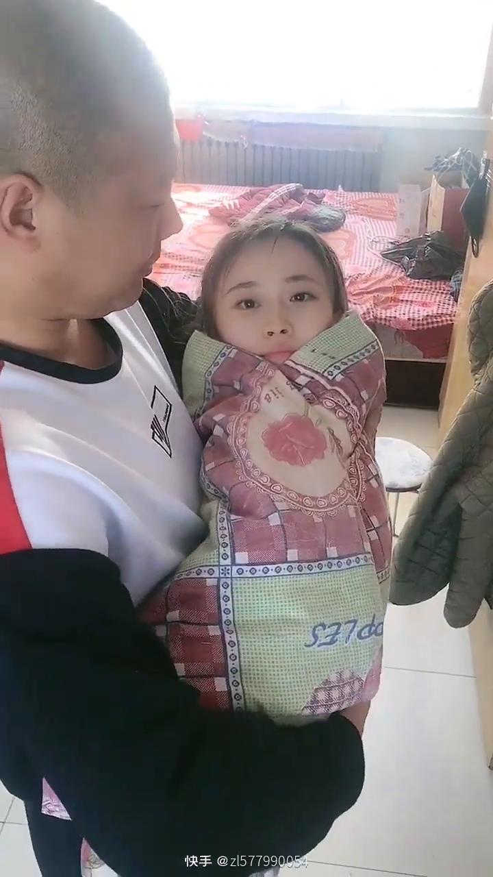 目前非常罕见的大头婴儿