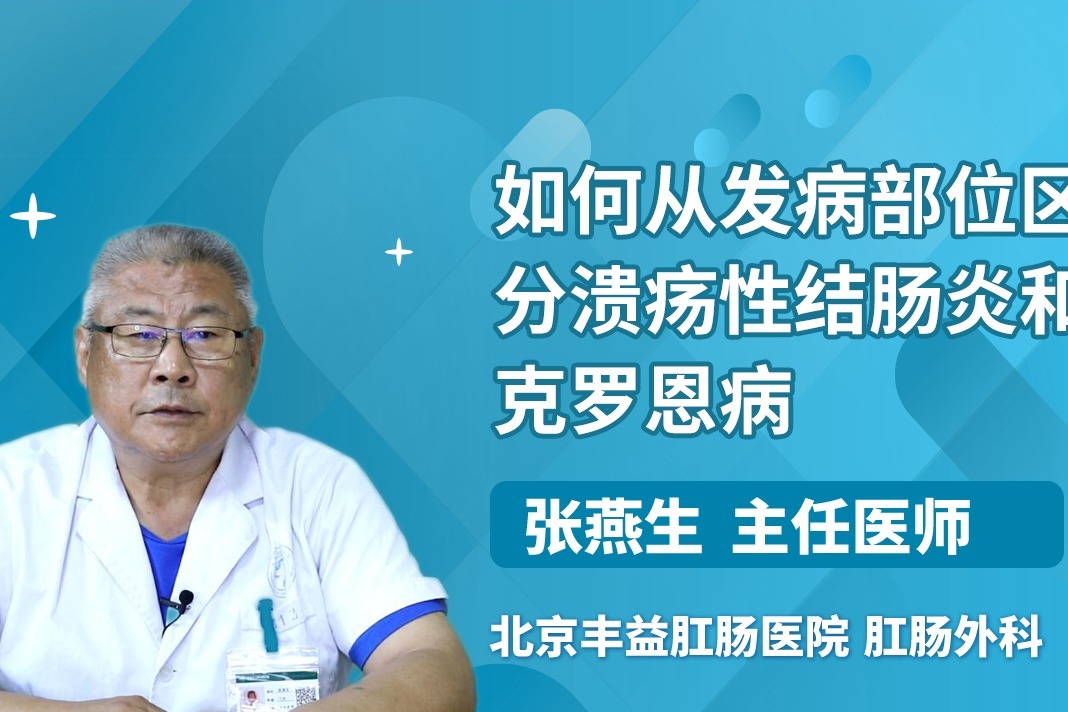 溃疡性结肠炎克罗恩病分不清很简单看发病部位就知道