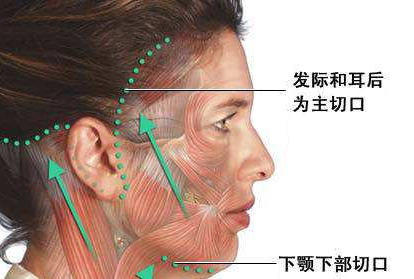 筋膜悬吊后要疼几天 筋膜悬吊术后要注意什么