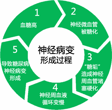 由糖尿病引起的神经病变,它也是各有不同点的!