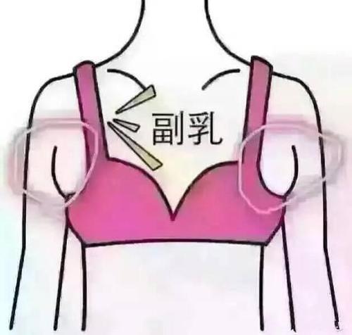 长治看乳腺疾病医院哪家比较好 长治圣爱妇产医院 为何会形成副乳
