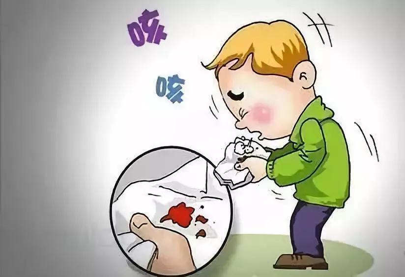 成都支气管扩张能治疗好吗