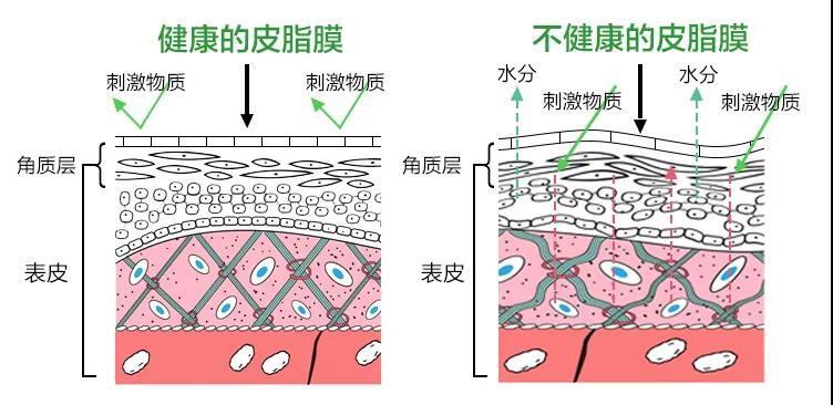 皮肤屏障受损会怎样?__凤凰网