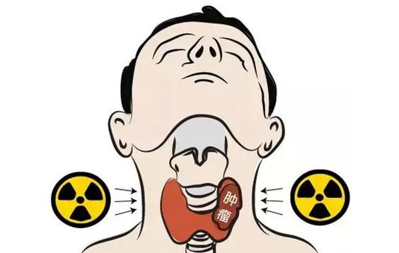 中医肿瘤牛小培-甲状腺癌是什么引起的?