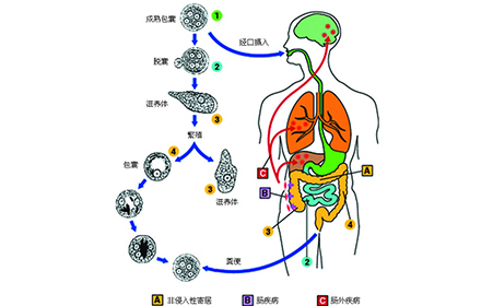 阿米巴性肝脓肿的发病原因是什么呢?很多人可能都没听说过这种病
